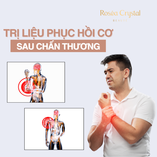 Trị Liệu Phục Hồi Cơ Sau Chấn Thương Nhẹ Với Công Nghệ GOG