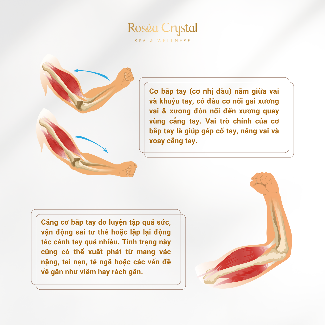 Nguyên Nhân và Cách Trị Liệu Căng Cơ Vùng Bắp Tay