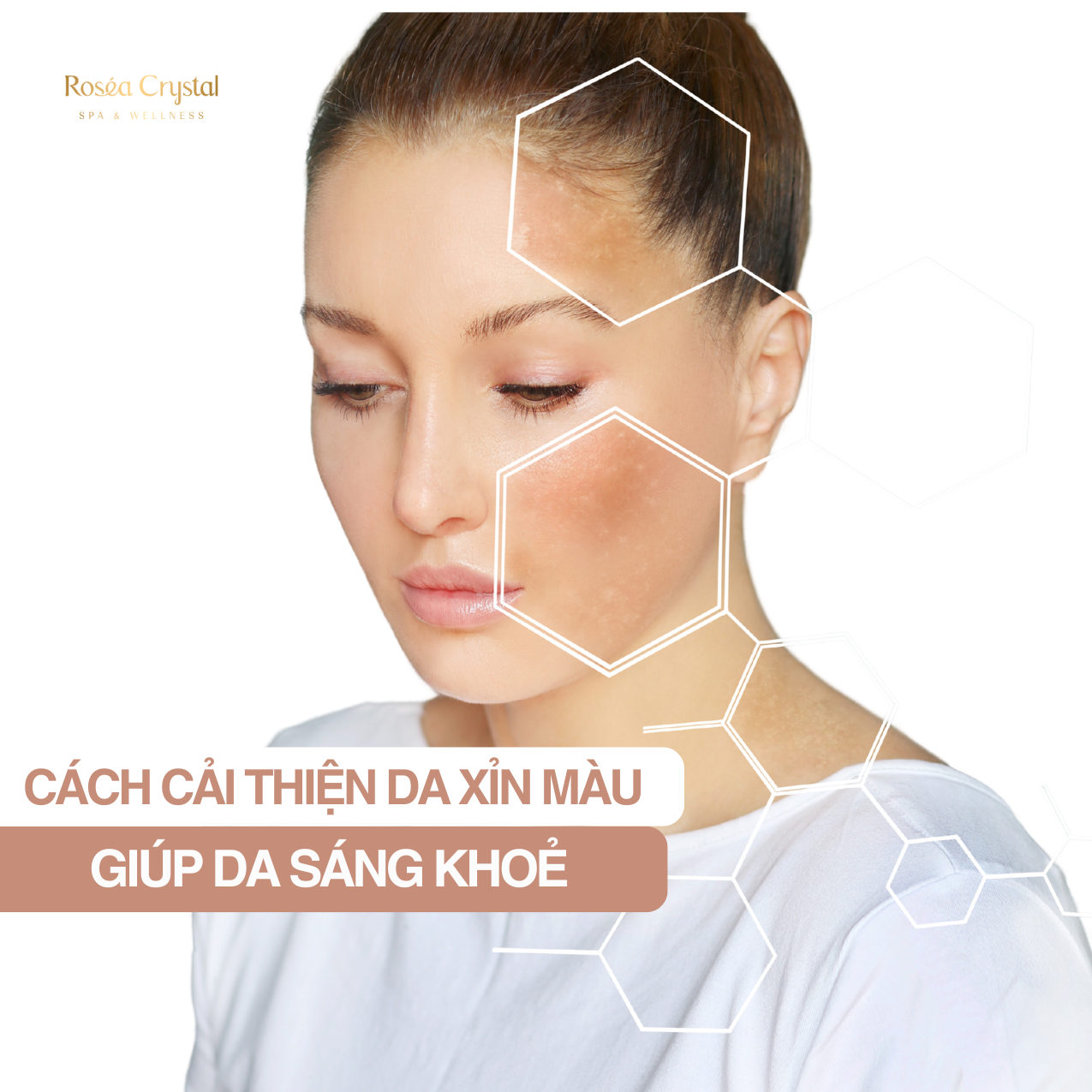 Cải Thiện Làn Da Xỉn Màu Giúp Da Sáng Khỏe